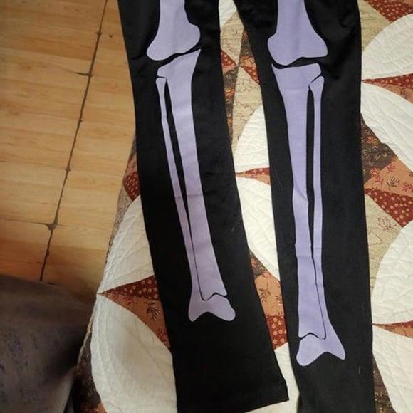 Skeleton - Picture 4 of 5